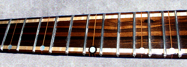 custom inlays